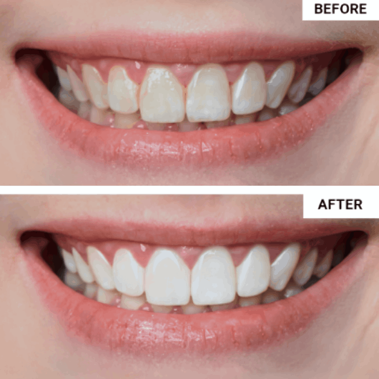Water Flosser customer~ Corinne G. – Bloomington, IN